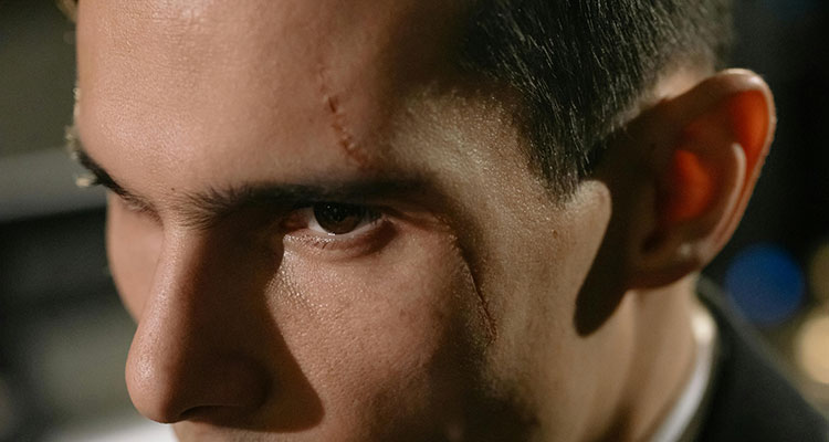 Facial Scarring and Disfigurement Claims in Minnesota